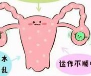 高龄女性去泰国申请试管成功率高吗？