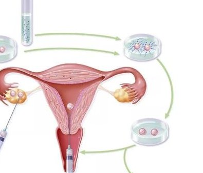 深圳试管婴儿的价格贵吗 三代试管去哪家医院做成功率高